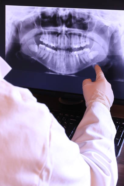 Best Emergency Treatment for Oral Infections in Athena, OR