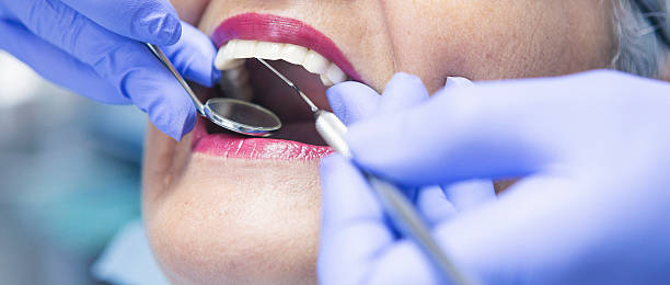 Best Knocked-Out Tooth (Avulsed Tooth) Treatment in Athena, OR